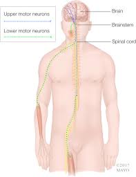 Pathophysiology and diagnosis of als: Amyotrophic Lateral Sclerosis An Update For 2018 Mayo Clinic Proceedings