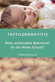 Autsch Textildermatitis 5 Haufige Ausloser In Babykleidung Nichtnurmama De Babykleidung Babymode Textil