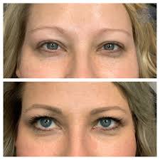 Erin Meier Aesthetics . Prime Line OKC