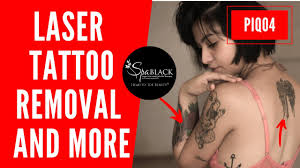 Medermis laser clinic, in austin, san antonio, fort worth, dallas, and houston, offering modern laser technology for affordable, safe and effective. Pico Laser Treatment San Antonio Spa Black