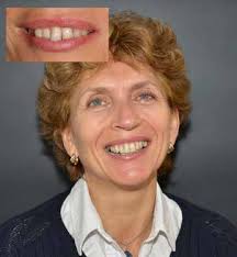 cover image: courtesy of Djemal Ibraimi