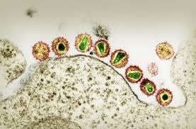 Medizin Hiv Patient Von Virus Befreit Wissen Stuttgarter Nachrichten