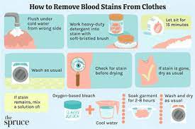 How To Remove Bloodstains From Clothes.