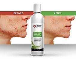 This ingrown hairs shaving cream contains profesional ingredients that help soothe hair bumps and protect ingrown hair prone black men and caucasians. Kerah Lane Razor Bump Ingrown Hair Formula 8 Oz For Women Men Best Treatment Serum For Ingrown Hairs Acne Razor Anus Uk