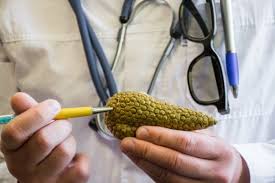 10 Consejos Para Siempre Mantener Limpio El Hogar Cancer De Pancreas El Cancer Salud