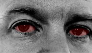 Image result for Eye Acidity Test