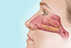 Image result for Rhinitis