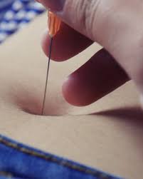 The umbilicus is used to visually separate the abdomen into quadrants. Belly Button Page 3 Bellycool