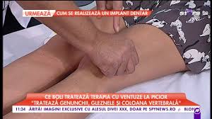 Videoclipul prezinta detalii asupra modului in care trebuie sa. Terapia Cu Ventuze La Picior SenzaÈie In Randul Divelor De La Hollywood Youtube