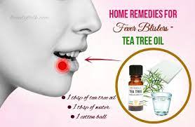 18 Best Home Remedies For Fever Blisters You Should Not Skip Fever Blister Remedy Fever Blister Home Remedies For Fever