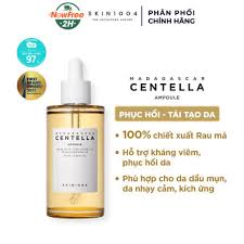 Top 5 Serum Trị Mụn Ẩn Hiệu Quả Nhất Hiện Nay