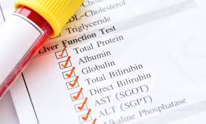 Image result for Liver Function Test Abnormality