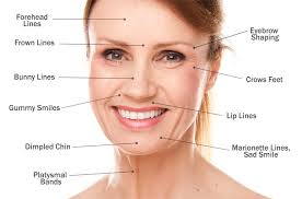 Where can you get botox on your face? Botox