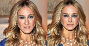 What procedures would give this level of midface shortening? (Photo)