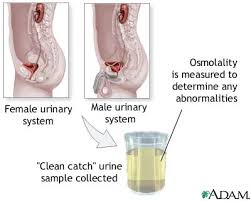 Separate the folds of the urinary opening with fingers and clean inside using one towelette, moving from the front to the back. Osmolality Urine Test Calgary Sun