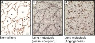 Ultimate hong kong halal food guide: Vessel Co Option And Resistance To Anti Angiogenic Therapy Springerlink