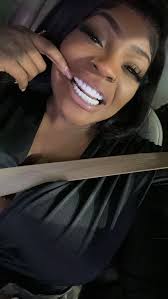 Should I get small teeth issues done first before veneers?