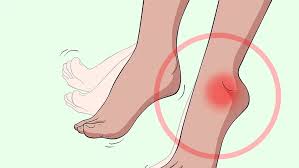 Image result for Foot Drop