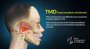 Pin On Physiotherapy