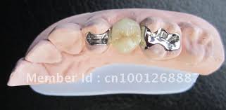 Penulis laporan ilmiah itu mendorong gigi palsu diambil sebelum si pasien menjalani anestesi. Maryland Bridge Crown False Teeth Chinese Supplier Teeth Organ Teeth Educationteeth Belt Aliexpress