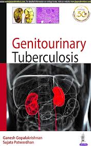 Image result for Genitourinary Tuberculosis
