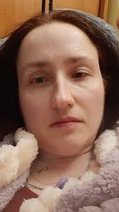 Witam serdecznie i gorąco błagam o wsparcie 🙏🙏🙏🙏. Potrzebuję leków i  rehabilitacji, wszystko w opisie zbiórki. Z okazji zbliżających się świąt  Bożego Narodzenia życzę wszystkim dużo zdrowia i szczęścia 🥰  https://www.siepomaga.pl/ania-bober |