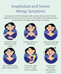 Nilmini W On Twitter Learned About A Great Resource Available For People With Allergies There Is An Allergy Unit In The University Of Sri Jayewardenapura And Several Specialists That Can Be Consulted