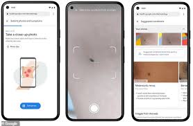 Download skin config terlengkap dengan mudah tanpa safelink nonton iklan melalui sebuah aplikasi. Google Unveils Ai Tool That Can Identify 288 Skin Conditions Todayuknews