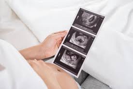 Image result for Ultrasound