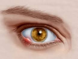 Image result for eye stye