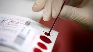 Image result for Infant Blood Sample