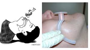 Image result for Advanced Airway