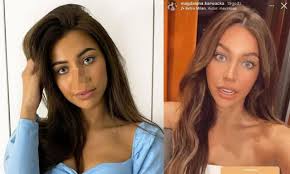 Już wkrótce piękna aktorka i jej partner powitają na świecie córkę. Magdalena Karwacka Z Love Island Miala Operacje Nosa Jak Wygladala Przed Operacja