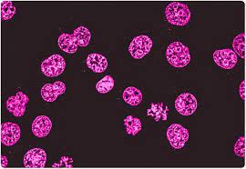 Fluorescence Microscopy Vs Light Microscopy