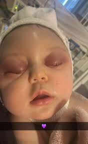 Lainey's Recovery and Health Updates