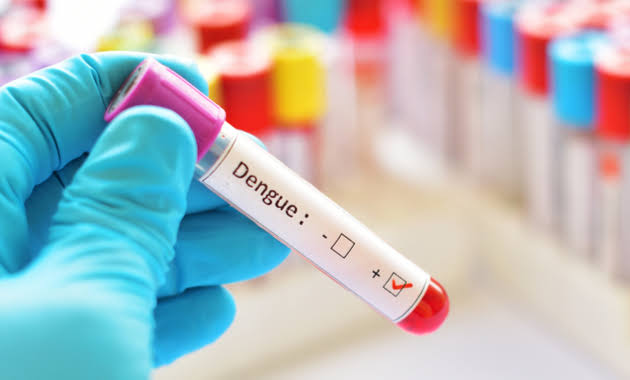 Dengue Test (NS1, IgG, IgM) product image