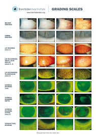 Echelle De Gradation Bhvi Contactologie