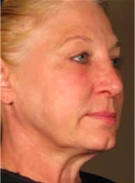 Mariam Awada, MD, FACS