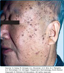 Preface A much-treasured legacy of Dr. Thomas B. Fitzpatrick, who served as  editor-in-chief for the first four editions of the b