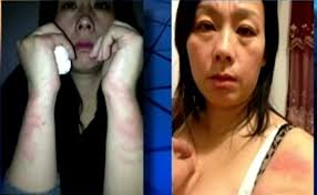 Gav goes to arizona to film a taser being deployed at a human target in super slow motion. Woman Left With Burns After Being Tasered By Police For Refusing To Leave Apple Store And Buying Too Many Iphones The Independent The Independent