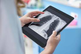 The rib cage attaches to the breastbone and spine, and the ribs protect many vital organs. Pneumothorax In The Lungs Symptoms Causes Diagnosis And Treatment