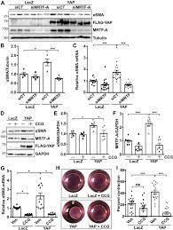 Advertising agency network, network membership, learm more about membership in amin worldwide. Blockade Of Fibroblast Yap Attenuates Cardiac Fibrosis And Dysfunction Through Mrtf A Inhibition Sciencedirect