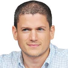 Hair thinning and hair loss by stress would show a more diffuse pattern, different from androgenetic alopecia. What Is Diffuse Hair Loss Telogen Effluvium Treatments