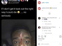 Lil uzi vert's $24 million brain diamond had us wondering. Us Rapper Lil Uzi Vert Bleeds From His Forehead After A 24million Pink Diamond Implant See Photo Watsup Tv