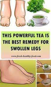 Parsley Is A Common Herb That Has A Large Use It Main Use Is As A Spice Because It Has Pleasant Aroma And Give Natural Cure For Arthritis Swollen Legs Health