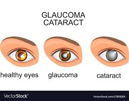 Pin On Opthalmology