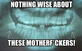 Cosmeticfamilydentaltoronto Finchdentist Dentistscarboroughtoronto Torontodentist Bestdentisttoronto Wisdom Teeth Impacted Wisdom Teeth Wisdom Teeth Meme