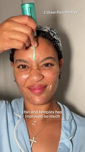 Snake Peel Loreal Before and After