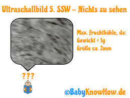 5 Ssw Symptome Anzeichen Ultraschall Entwicklung
