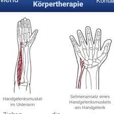 Wie Bekomme Ich Schmerzen Im Unterarm Handgelenk Weg Und Wie Kommt Es Das Ich Da So Schnell Schmerzen Bekomme Menschen Korper Arzt